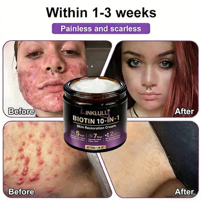Made and Shipped from USA🍁INKLULL® Biotin 10-in-1 Skin Restoration Cream - Last Day Promotion: 75% OFF