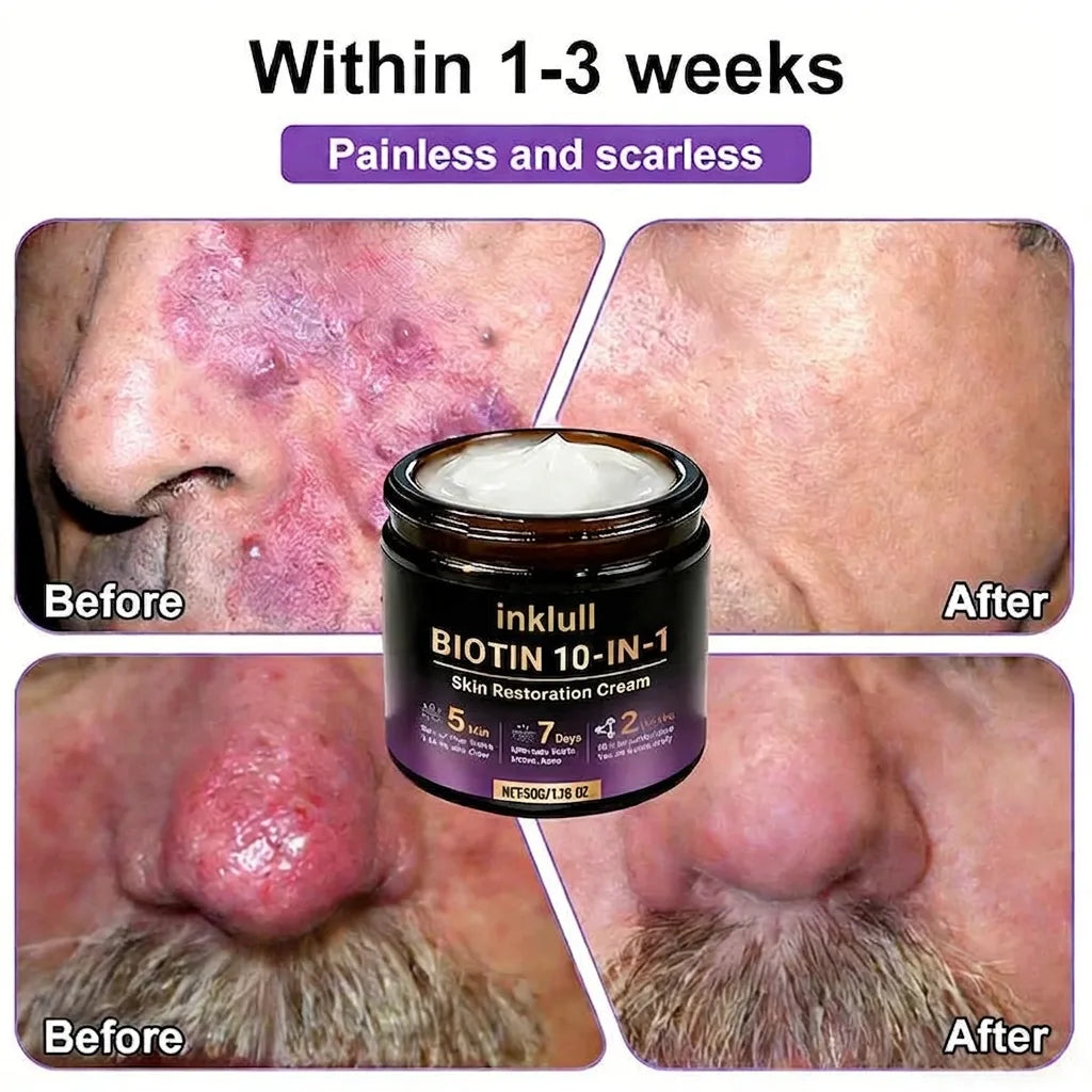 Made and Shipped from USA🍁INKLULL® Biotin 10-in-1 Skin Restoration Cream - Last Day Promotion: 75% OFF