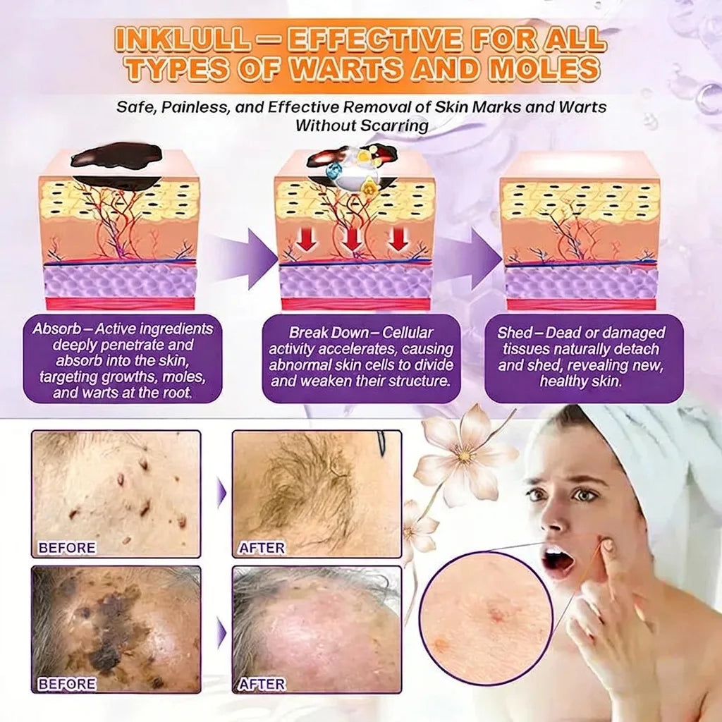 Made and Shipped from USA🍁INKLULL® Biotin 10-in-1 Skin Restoration Cream - Last Day Promotion: 75% OFF