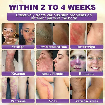 Made and Shipped from USA🍁INKLULL® Biotin 10-in-1 Skin Restoration Cream - Last Day Promotion: 75% OFF