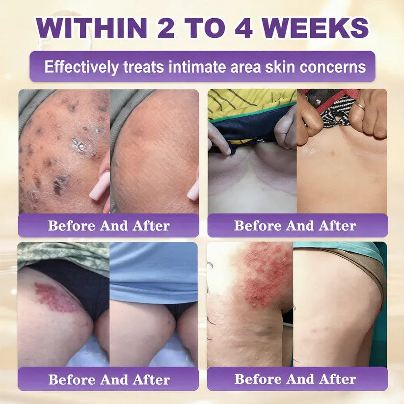 Made and Shipped from USA🍁INKLULL® Biotin 10-in-1 Skin Restoration Cream - Last Day Promotion: 75% OFF