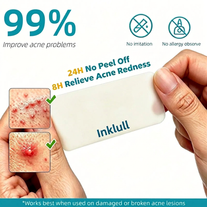 INKLULL® Medical-Grade Hydrocolloid Acne Patch Roll🌿 | Cuttable Overnight Spot Treatment | 2" × 16ft Large Roll