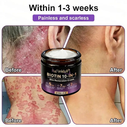 Made and Shipped from USA🍁INKLULL® Biotin 10-in-1 Skin Restoration Cream - Last Day Promotion: 75% OFF