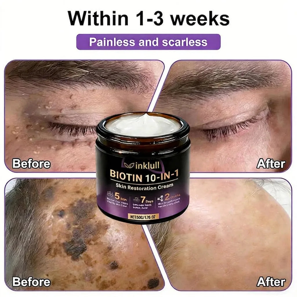 Made and Shipped from USA🍁INKLULL® Biotin 10-in-1 Skin Restoration Cream - Last Day Promotion: 75% OFF